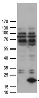 FABP12 Antibody - HEK293T cells were transfected with the pCMV6-ENTRY control. (Left lane) or pCMV6-ENTRY FABP12. (Right lane) cDNA for 48 hrs and lysed