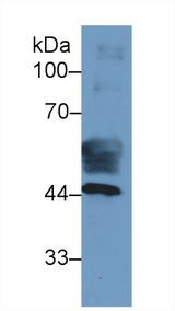 FABP3 / H-FABP Antibody - Western Blot; Sample: Human Placenta lysate; Primary Ab: 2µg/ml Mouse Anti-Human KRT19 Antibody Second Ab: 0.2µg/mL HRP-Linked Caprine Anti-Mouse IgG Polyclonal Antibody