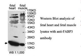 FABP3 / H-FABP Antibody