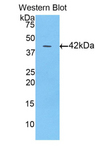 FABP3 / H-FABP Antibody - Western blot of recombinant FABP3 / H-FABP.  This image was taken for the unconjugated form of this product. Other forms have not been tested.