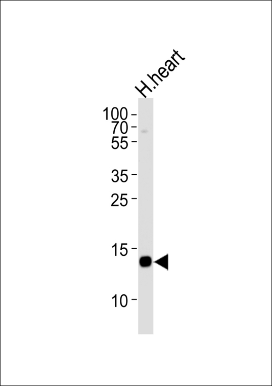 FABP3 / H-FABP Antibody - Western blot of lysate from human heart tissue lysate, using FABP3 Antibody. Antibody was diluted at 1:1000 at each lane. A goat anti-rabbit IgG H&L (HRP) at 1:5000 dilution was used as the secondary antibody. Lysate at 35ug per lane.