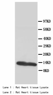 FABP3 / H-FABP Antibody -  This image was taken for the unconjugated form of this product. Other forms have not been tested.