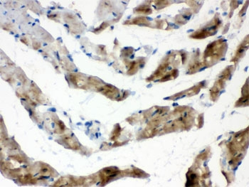 FABP3 / H-FABP Antibody - IHC-P: FABP3 antibody testing of rat heart tissue