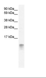 FABP3 / H-FABP Antibody - Fetal Heart Lysate.  This image was taken for the unconjugated form of this product. Other forms have not been tested.