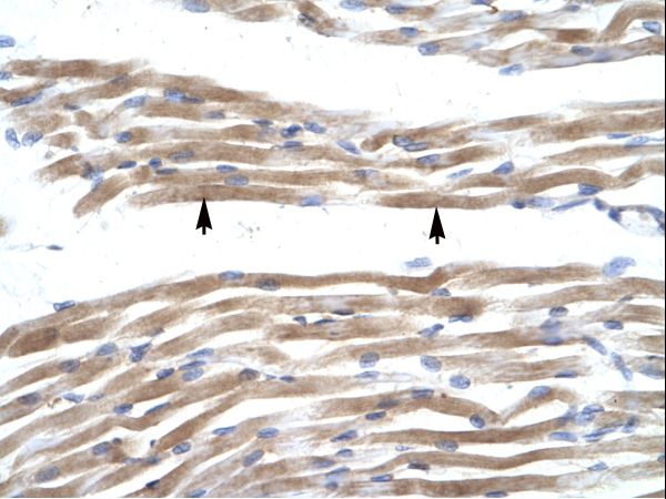 FABP3 / H-FABP Antibody - FABP3 antibody ARP33823_T100-NP_004093-FABP3 (fatty acid binding protein 3, muscle and heart (mammary-derived growth inhibitor)) Antibody was used in IHC to stain formalin-fixed, paraffin-embedded human muscle.  This image was taken for the unconjugated form of this product. Other forms have not been tested.