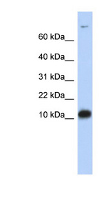 FABP3 / H-FABP Antibody - FABP3 antibody Western blot of Fetal Brain lysate. This image was taken for the unconjugated form of this product. Other forms have not been tested.