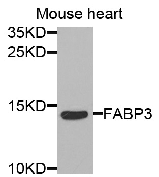 FABP3 / H-FABP Antibody - Western blot analysis of extracts of mouse heart cells.