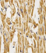 FABP3 / H-FABP Antibody - Immunohistochemical of paraffin-embedded H. heart section using FABP3. Antibody was diluted at 1:25 dilution. A peroxidase-conjugated goat anti-rabbit IgG at 1:400 dilution was used as the secondary antibody, followed by DAB staining.