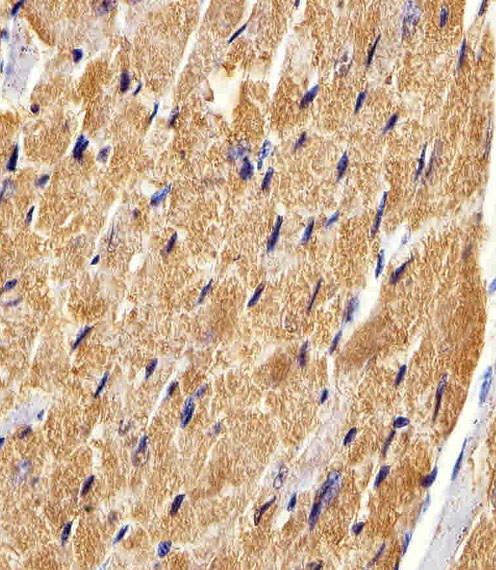 FABP3 / H-FABP Antibody - Immunohistochemical of paraffin-embedded M. heart section using FABP3. Antibody was diluted at 1:25 dilution. A peroxidase-conjugated goat anti-rabbit IgG at 1:400 dilution was used as the secondary antibody, followed by DAB staining.