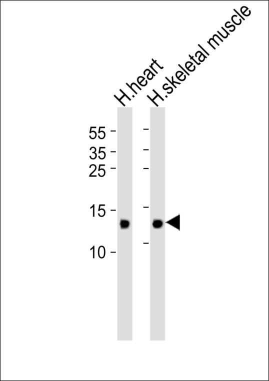 FABP3 / H-FABP Antibody - Western blot of lysates from human heart and skeletal muscle tissue lysate (from left to right) with FABP3 Antibody. Antibody was diluted at 1:1000 at each lane. A goat anti-rabbit IgG H&L (HRP) at 1:5000 dilution was used as the secondary antibody. Lysates at 35 ug per lane.