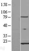 FABP3 / H-FABP Protein - Western validation with an anti-DDK antibody * L: Control HEK293 lysate R: Over-expression lysate