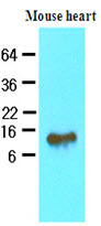 FABP4 / AP2 Antibody - The extracts of mouse heart (40 ug) were resolved by SDS-PAGE, transferred to NC membrane and probed with anti-human FABP4 (1:500). Proteins were visualized using a goat anti-mouse secondary antibody conjugated to HRP and an ECL detection system.