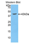 FABP4 / AP2 Antibody - Western blot of recombinant FABP4 / AP2.  This image was taken for the unconjugated form of this product. Other forms have not been tested.