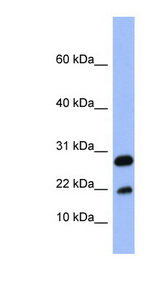 FABP4 / AP2 Antibody - FABP4 antibody Western blot of Fetal Spleen lysate. This image was taken for the unconjugated form of this product. Other forms have not been tested.
