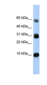 FABP4 / AP2 Antibody - FABP4 antibody Western blot of Fetal Muscle lysate. This image was taken for the unconjugated form of this product. Other forms have not been tested.