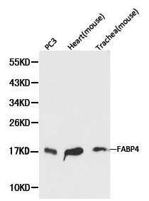 FABP4 / AP2 Antibody - Western blot of FABP4 pAb in extracts from PC3 cells,mouse heart and mouse trachea tissues.
