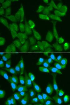 FABP4 / AP2 Antibody - Immunofluorescence analysis of HeLa cells.