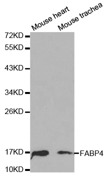 FABP4 / AP2 Antibody - Western blot analysis of extracts of various cell lines, using FABP4 antibody at 1:1000 dilution. The secondary antibody used was an HRP Goat Anti-Rabbit IgG (H+L) at 1:10000 dilution. Lysates were loaded 25ug per lane and 3% nonfat dry milk in TBST was used for blocking.