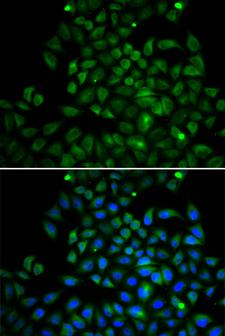 FABP4 / AP2 Antibody - Immunofluorescence analysis of A549 cells using FABP4 antibody. Blue: DAPI for nuclear staining.