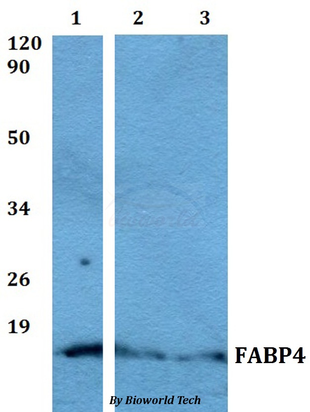 FABP4 / AP2 Antibody - Western blot of FABP4 antibody at 1:500 dilution. Lane 1: Jurkat whole cell lysate. Lane 2: H9C2 whole cell lysate. Lane 3: PC12 whole cell lysate.