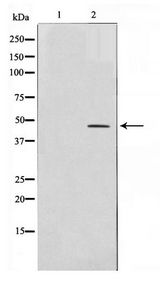 FABP4 / AP2 Antibody - Western blot of COLO205 cell lysate using AP-2 Antibody