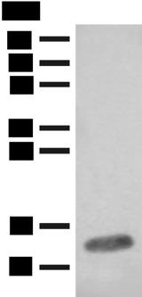 FABP4 / AP2 Antibody - Western blot analysis of Mouse heart tissue lysate  using FABP4 Polyclonal Antibody at dilution of 1:400