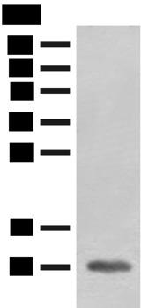 FABP4 / AP2 Antibody - Western blot analysis of Mouse heart tissue lysate  using FABP4 Polyclonal Antibody at dilution of 1:400