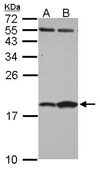FABP7 / BLBP / MRG Antibody - Sample (30 ug of whole cell lysate) A: NT2D1 B: IMR32 15% SDS PAGE FABP7 / BLBP antibody diluted at 1:1000
