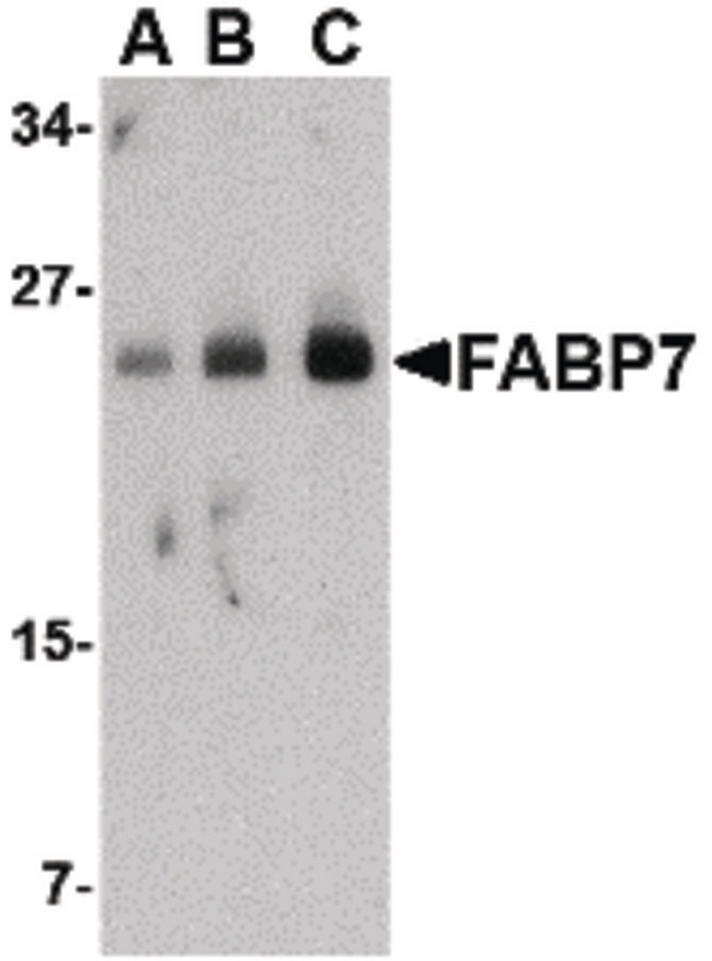 FABP7 / BLBP / MRG Antibody - Western blot of FABP7 in human breast tissue lysate with FABP7 antibody at (A) 0.5, (B) 1 and (C) 2 ug/ml.