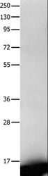 FABP7 / BLBP / MRG Antibody - Western blot analysis of Human fetal brain tissue, using FABP7 Polyclonal Antibody at dilution of 1:450.