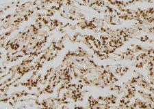 FABP7 / BLBP / MRG Antibody - 1:100 staining human lung tissue by IHC-P. The sample was formaldehyde fixed and a heat mediated antigen retrieval step in citrate buffer was performed. The sample was then blocked and incubated with the antibody for 1.5 hours at 22°C. An HRP conjugated goat anti-rabbit antibody was used as the secondary.