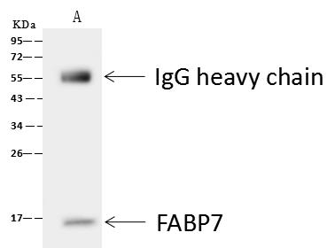 FABP7 / BLBP / MRG Antibody - FABP7 was immunoprecipitated using: Lane A: 0.5 mg U251MG Whole Cell Lysate. 4 uL anti-FABP7 rabbit polyclonal antibody and 60 ug of Immunomagnetic beads Protein A/G. Primary antibody: Anti-FABP7 rabbit polyclonal antibody, at 1:100 dilution. Secondary antibody: Goat Anti-Rabbit IgG (H+L)/HRP at 1/10000 dilution. Developed using the ECL technique. Performed under reducing conditions. Predicted band size: 15 kDa. Observed band size: 15 kDa.