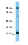 FABP9 / Lipid-Binding Protein Antibody - FABP9 / Lipid-Binding Protein antibody Western Blot of Fetal Heart.  This image was taken for the unconjugated form of this product. Other forms have not been tested.