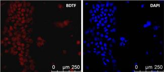 FAC1 / BPTF Antibody - FALZ Antibody in Immunofluorescence (IF)