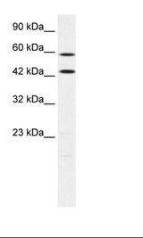 FACL2 / ACSL1 Antibody - HepG2 Cell Lysate.  This image was taken for the unconjugated form of this product. Other forms have not been tested.