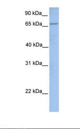 FACL2 / ACSL1 Antibody - MCF7 cell lysate. Antibody concentration: 1.0 ug/ml. Gel concentration: 12%.  This image was taken for the unconjugated form of this product. Other forms have not been tested.