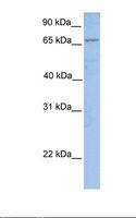 FACL2 / ACSL1 Antibody - MCF7 cell lysate. Antibody concentration: 1.0 ug/ml. Gel concentration: 12%.  This image was taken for the unconjugated form of this product. Other forms have not been tested.