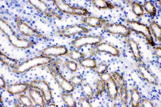 FACL2 / ACSL1 Antibody - ACSL1 was detected in paraffin-embedded sections of rat kidney tissues using rabbit anti- ACSL1 Antigen Affinity purified polyclonal antibody