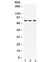 FACL2 / ACSL1 Antibody - Western blot testing of 1) rat liver, 2) mouse HEPA and 3) A549 lysate with ACSL1 antibody at 0.5ug/ml. Predicted molecular weight ~78 kDa.