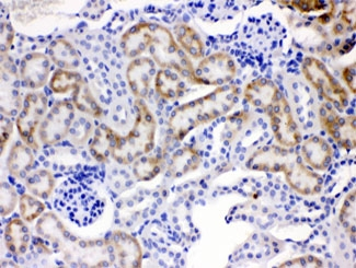 FACL2 / ACSL1 Antibody - IHC testing of FFPE mouse kidney tissue with ACSL1 antibody at 1ug/ml. HIER: steam sections in pH6 citrate buffer for 20 min.