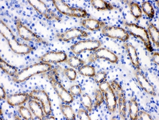 FACL2 / ACSL1 Antibody - IHC testing of FFPE rat kidney tissue with ACSL1 antibody at 1ug/ml. HIER: steam sections in pH6 citrate buffer for 20 min.