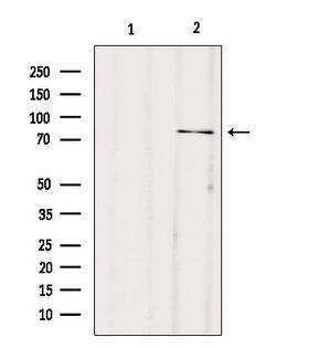 FACL2 / ACSL1 Antibody - Western blot analysis of extracts of mouse muscle using ACSL1 antibody. Lane 1 was treated with the blocking peptide.