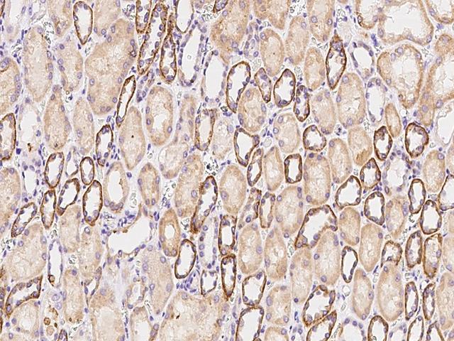 FACL2 / ACSL1 Antibody - Immunochemical staining of human ACSL1 in human kidney with rabbit polyclonal antibody at 1:300 dilution, formalin-fixed paraffin embedded sections.