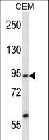 FACT / SSRP1 Antibody - SSRP1 Antibody western blot of CEM cell line lysates (35 ug/lane). The SSRP1 antibody detected the SSRP1 protein (arrow).