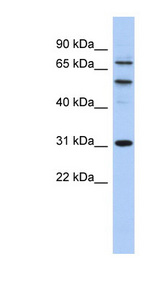 FACT / SSRP1 Antibody - SSRP1 antibody Western blot of OVCAR-3 cell lysate. This image was taken for the unconjugated form of this product. Other forms have not been tested.