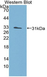 FACT / SSRP1 Antibody - Western blot of recombinant FACT / SSRP1.