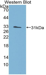 FACT / SSRP1 Antibody - Western blot of recombinant FACT / SSRP1.