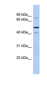 FACT / SSRP1 Antibody - SSRP1 antibody Western blot of Fetal Spleen lysate. This image was taken for the unconjugated form of this product. Other forms have not been tested.