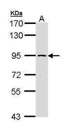 FACT / SSRP1 Antibody - Sample (30 ug of whole cell lysate). A: Molt-4 . 7.5% SDS PAGE. FACT / SSRP1 antibody diluted at 1:1000.