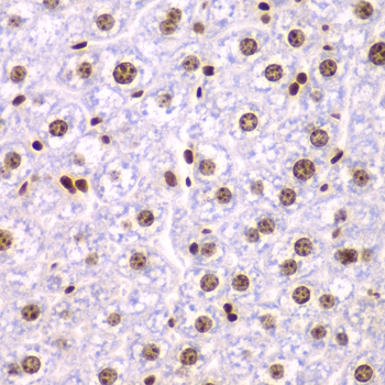 FACT / SSRP1 Antibody - Immunohistochemistry of paraffin-embedded mouse liver tissue.